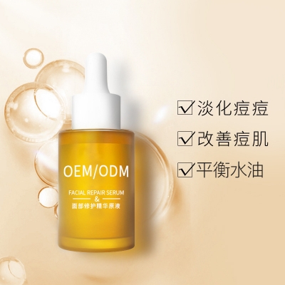 深水埗区_祛痘精华原液OEM